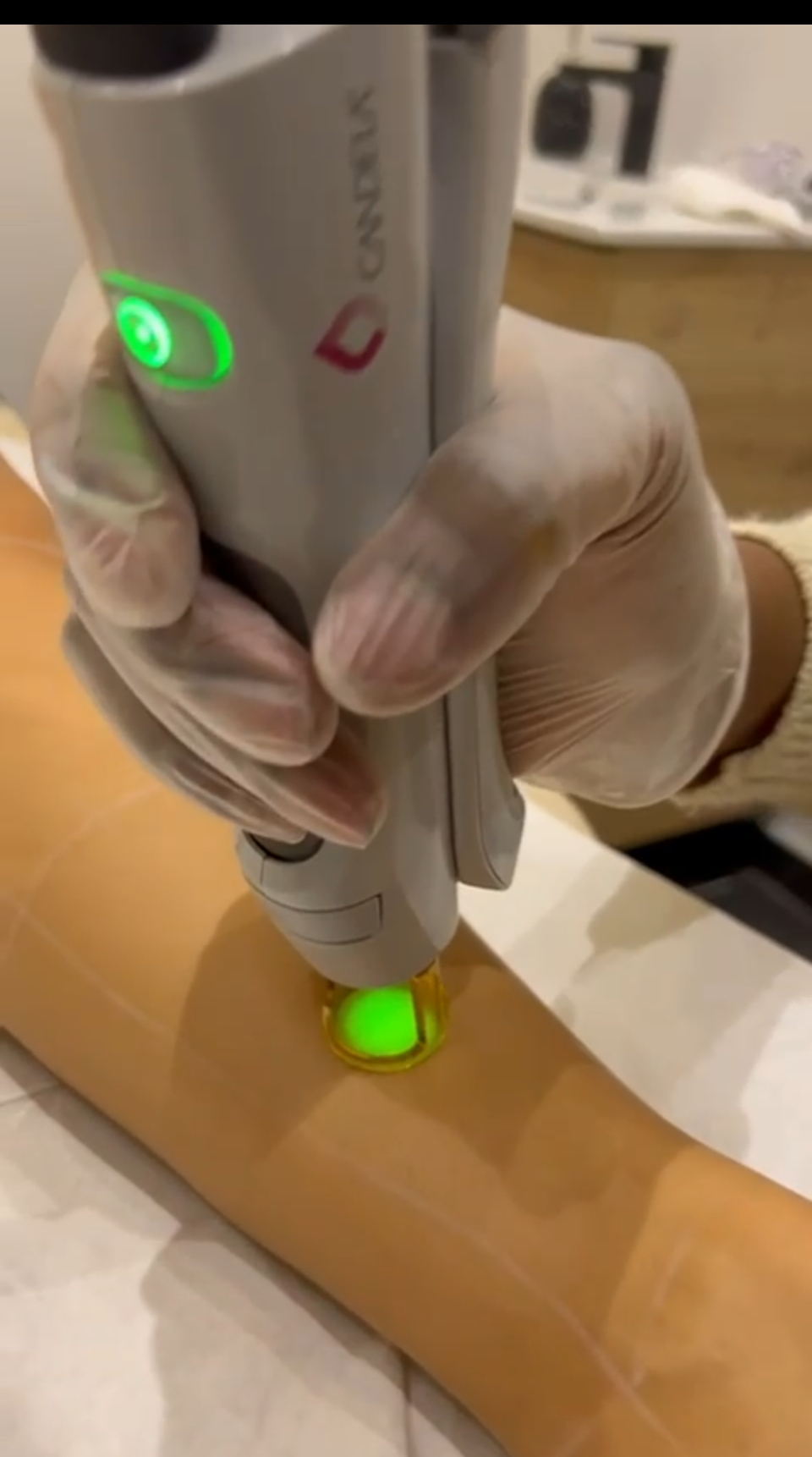 Laser haute technologie sécurisé