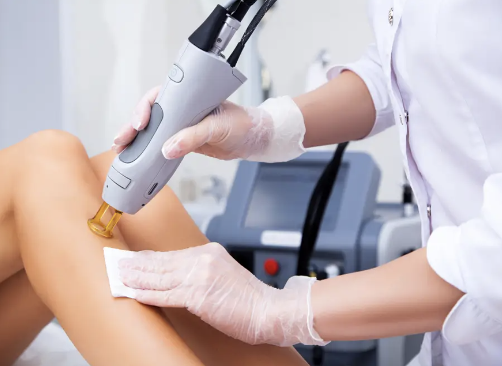 Épilation laser 